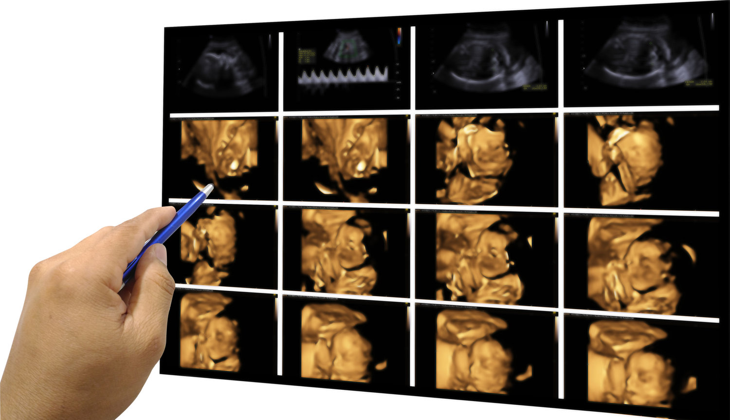 3D/4D/HD UltraSound Services - Premiere Baby Imaging