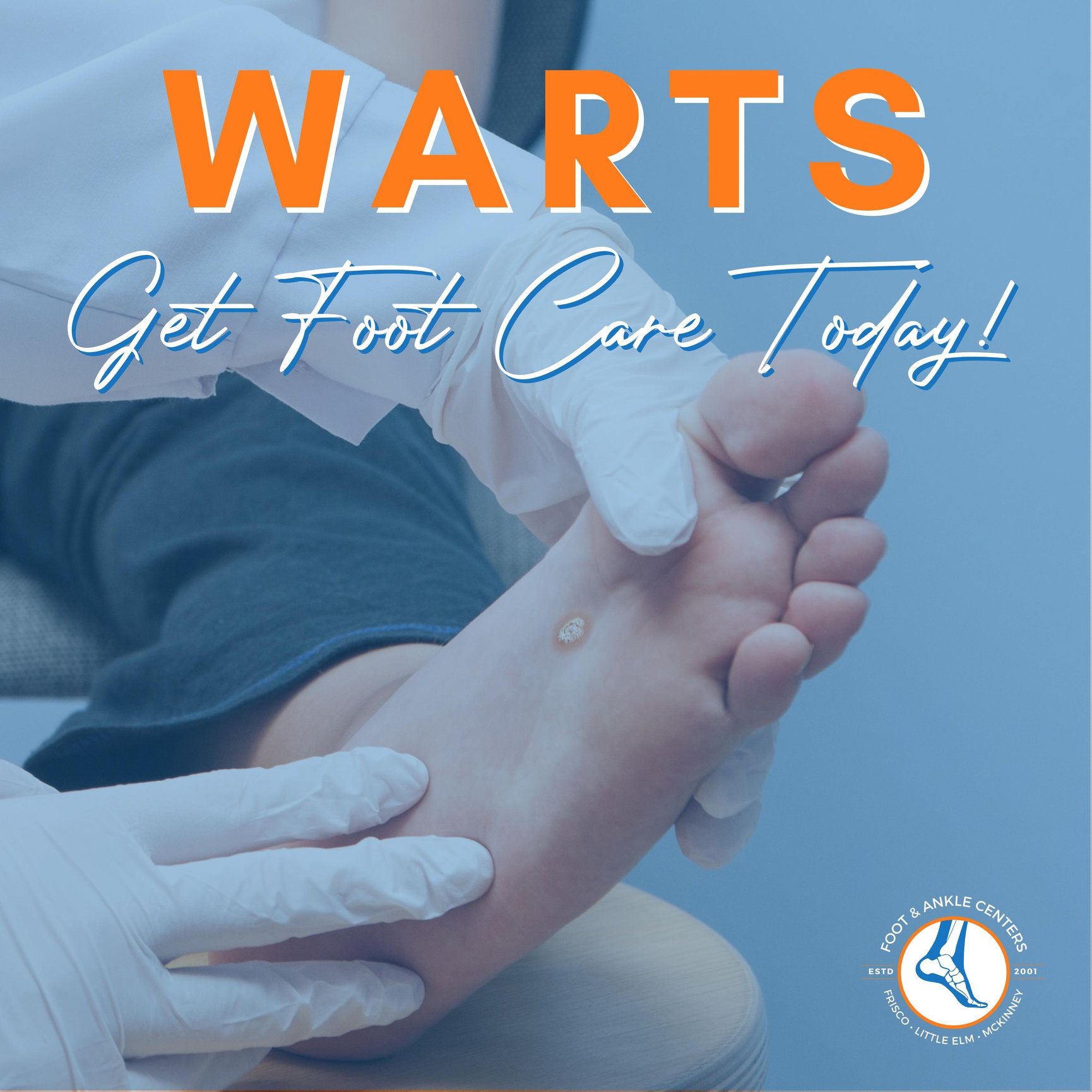Plantar Warts Foot & Ankle Centers of Frisco and Plano