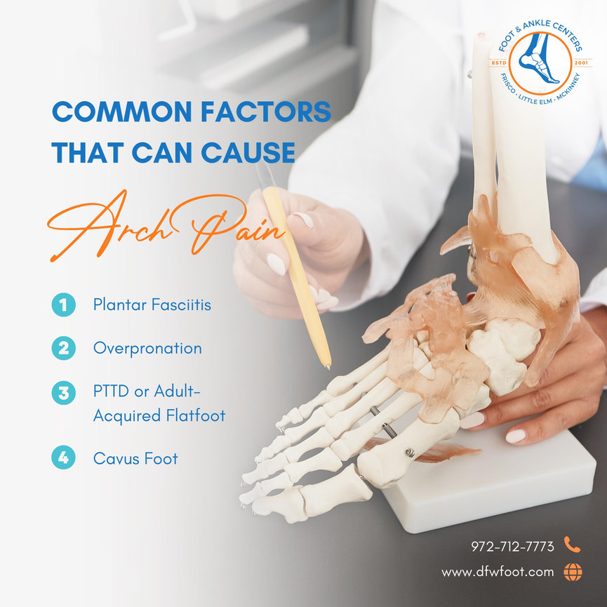 Arch Injury Common Factors That Can Cause Arch Pain - Foot & Ankle Centers of ...