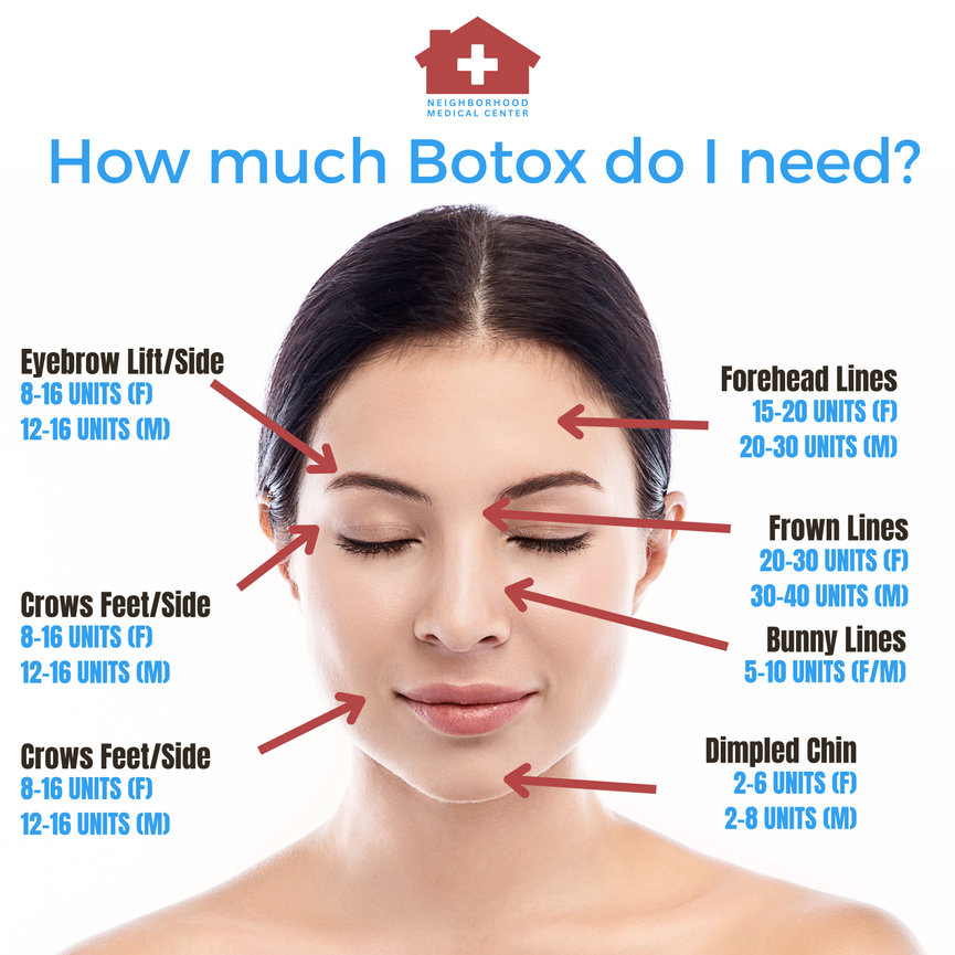 How Much BOTOX Do I Need? Located in Dallas, Texas - Neighborhood ...