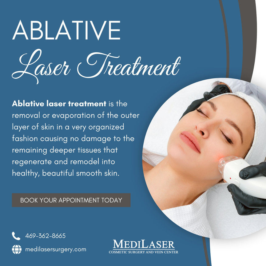 Ablative Laser Treatment at Medilaser Surgery and Vein Center in Frisco ...